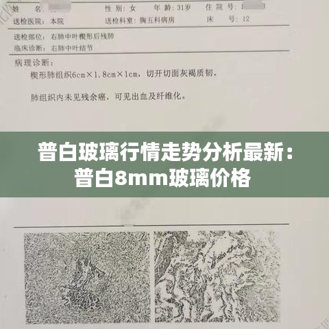 普白玻璃行情走势分析最新：普白8mm玻璃价格 