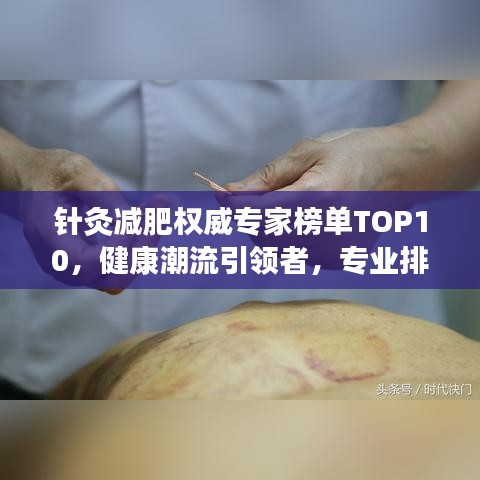针灸减肥权威专家榜单TOP10，健康潮流引领者，专业排名助你选对名医！